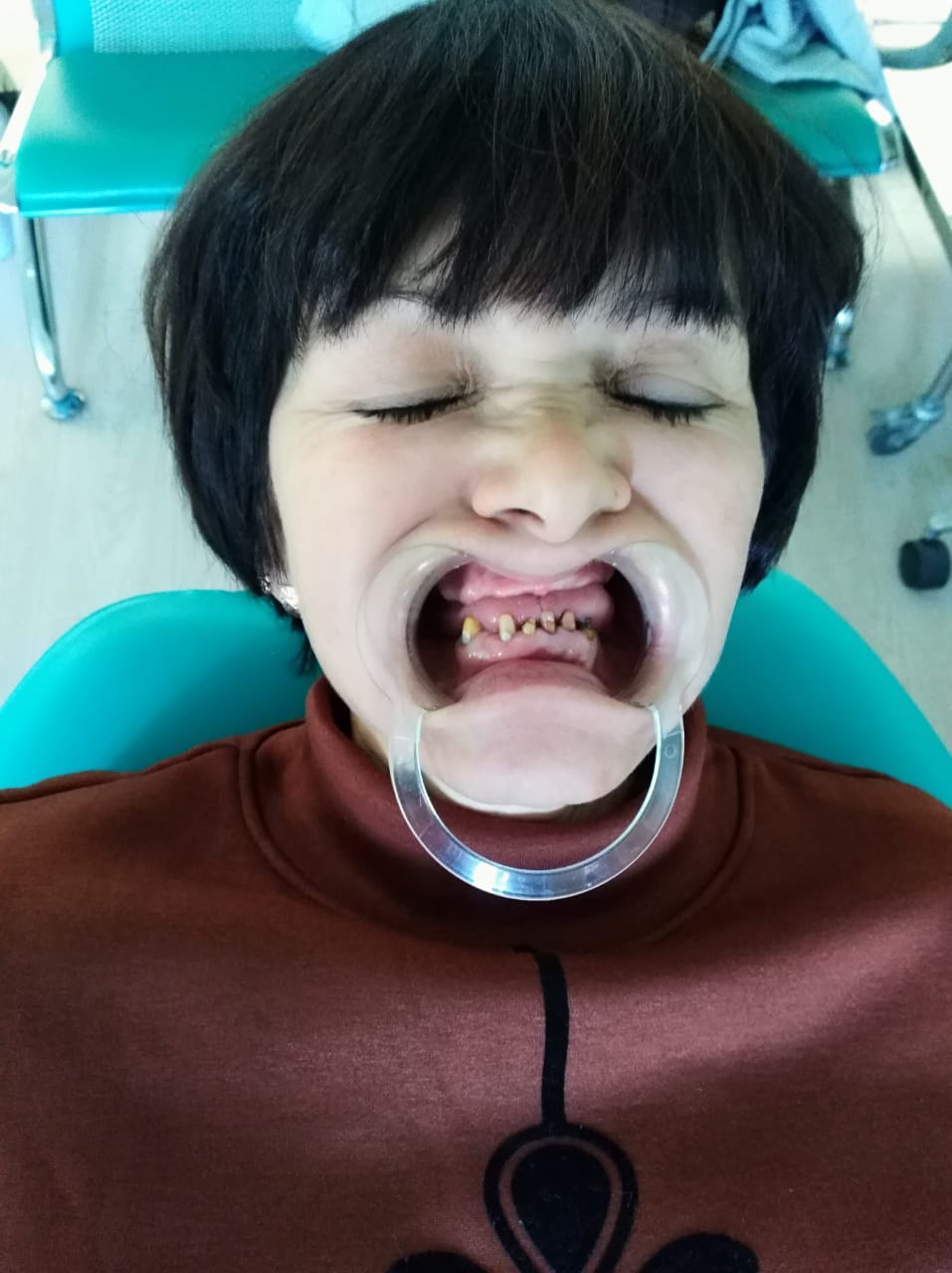 до и после вставить зубы в Китае